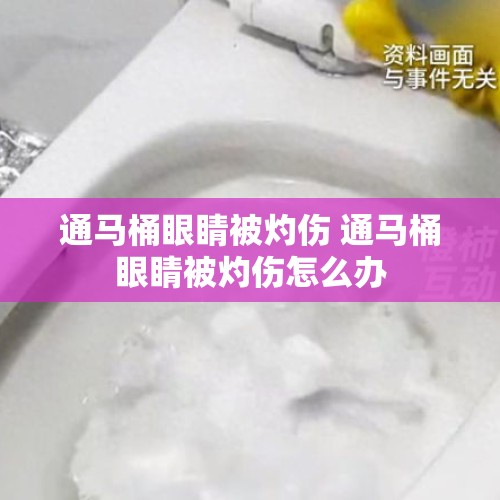 通马桶眼睛被灼伤 通马桶眼睛被灼伤怎么办