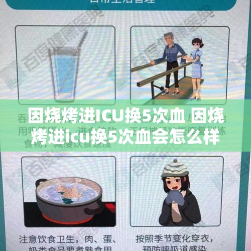 因烧烤进ICU换5次血 因烧烤进icu换5次血会怎么样